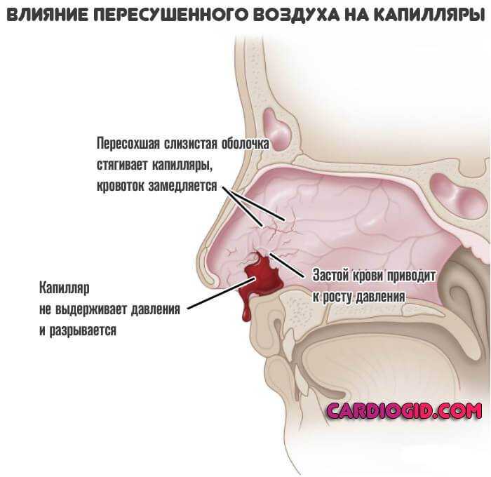 К чему снится кровь из носа 🩸👃 во сне, сонник - кровотечение, толкование снов