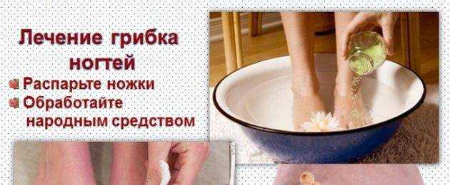 Обработка ногтей от грибка, онихомикоза в центре подологии podolab