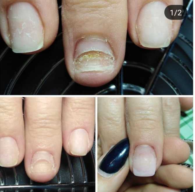 К чему снятся ногти