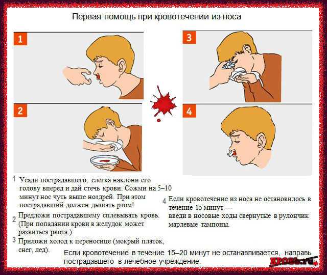 К чему снится кровь. видеть во сне кровь - сонник дома солнца