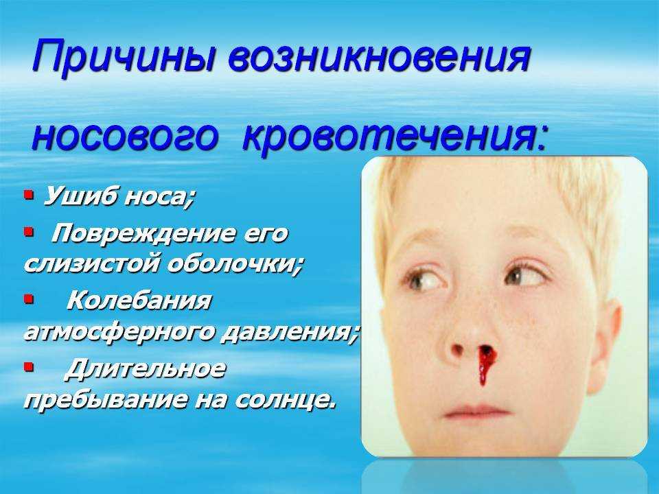 Оказание первой помощи при кровотечениях
