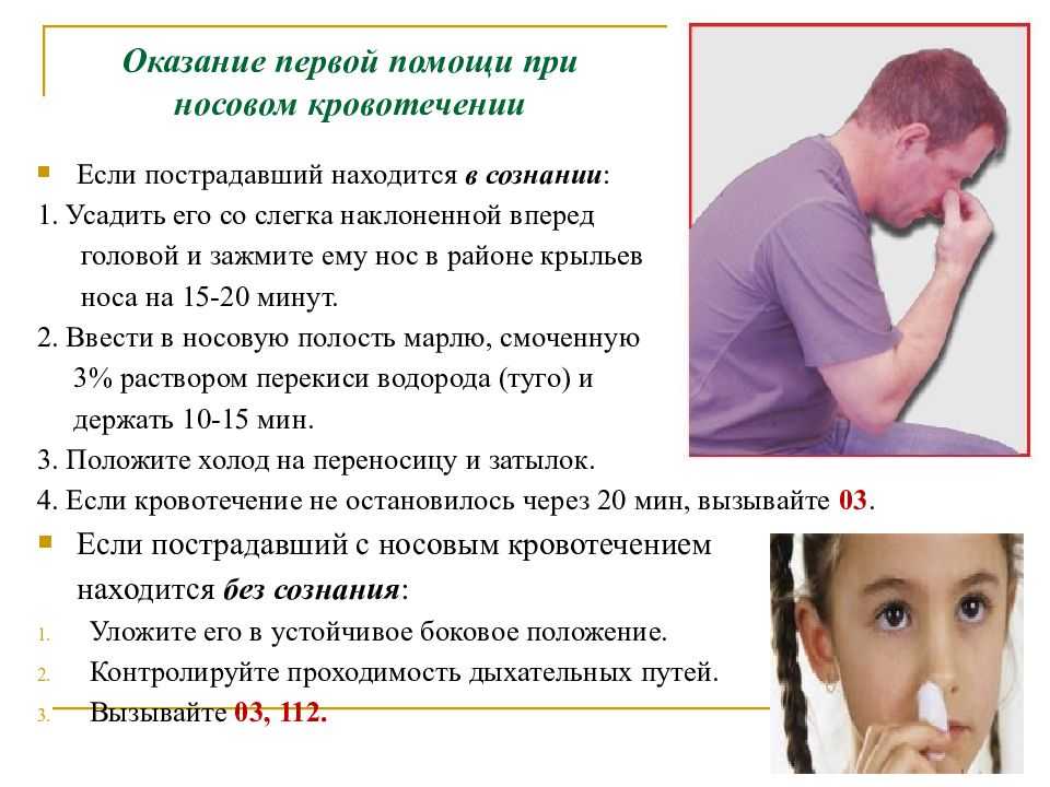 К чему снится кровь из носа — подробное толкование по сонникам