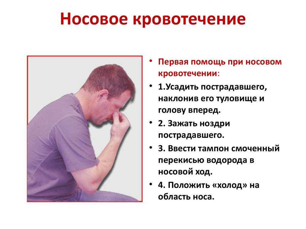 К чему снится кровь из носа: у себя или других?